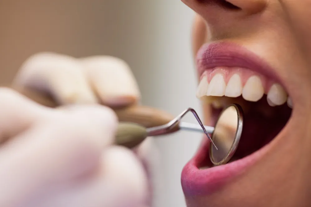 Revisión dental con espejo intraoral